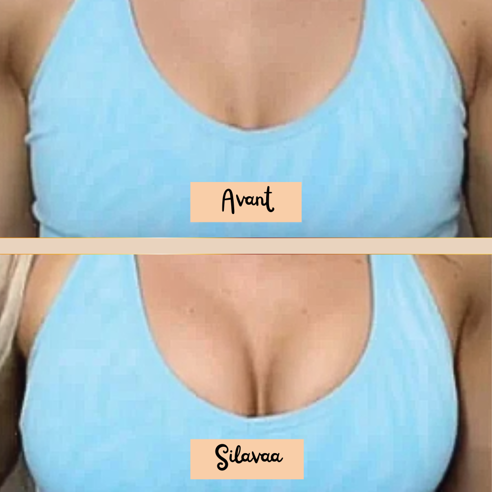 Push Up Adhésif - Silavaa™